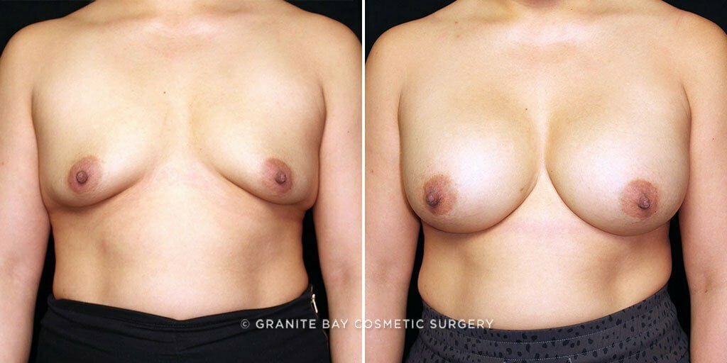 Case # 43 after photo