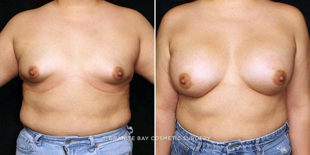 Case # 45 after photo