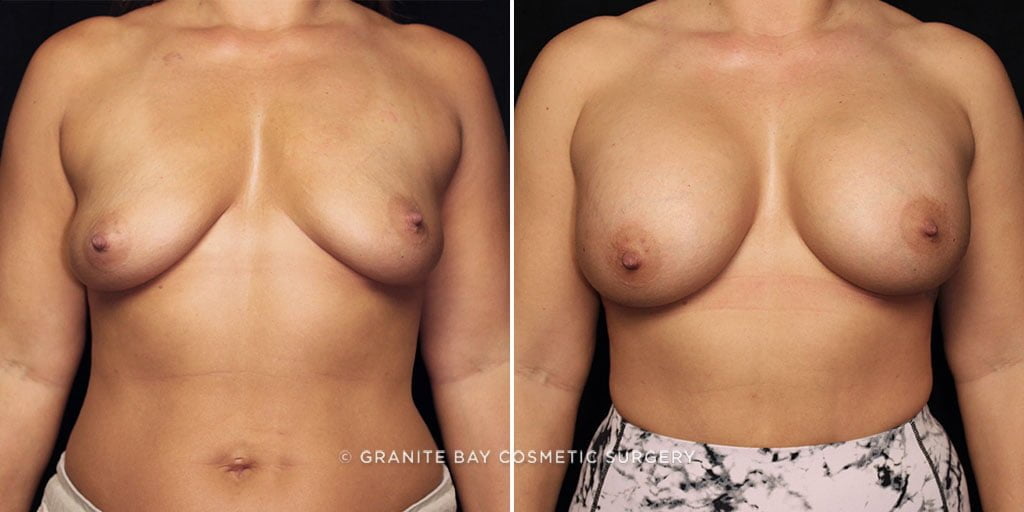 Case # 46 after photo