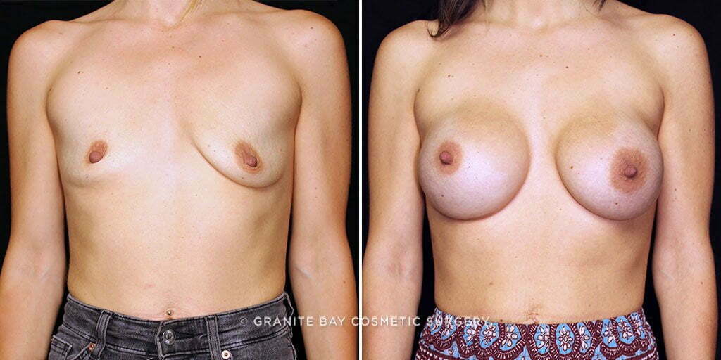 Case # 47 after photo