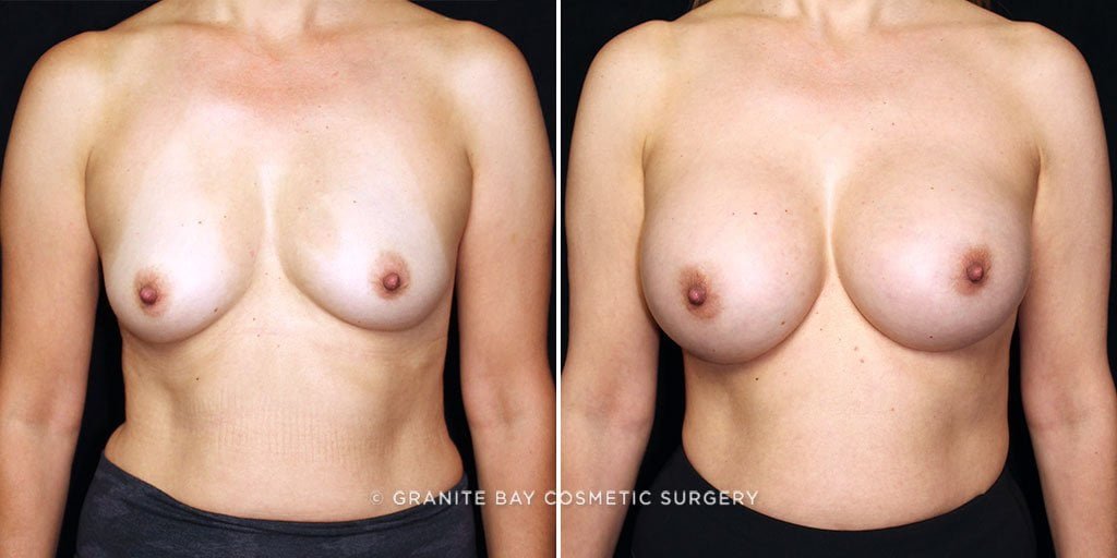 Case # 49 after photo