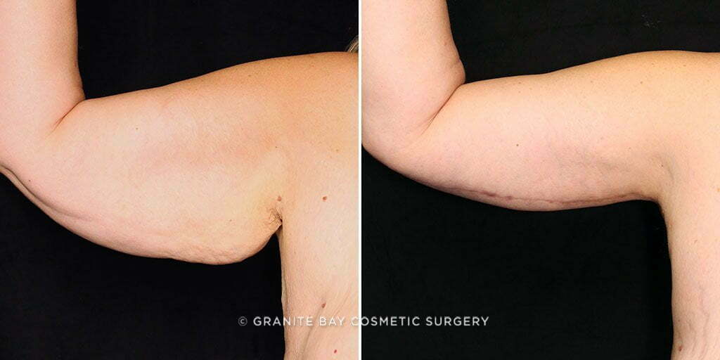 Case # 5 after photo