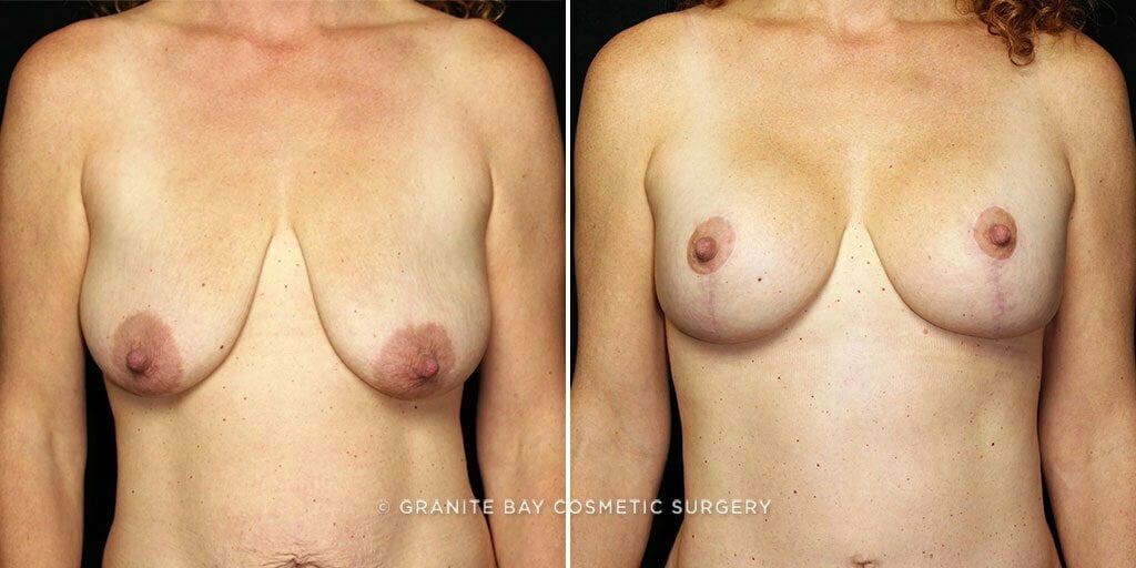 Case # 16 after photo