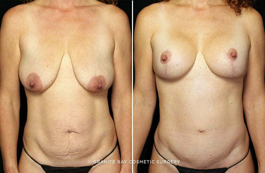 Case # 28 after photo