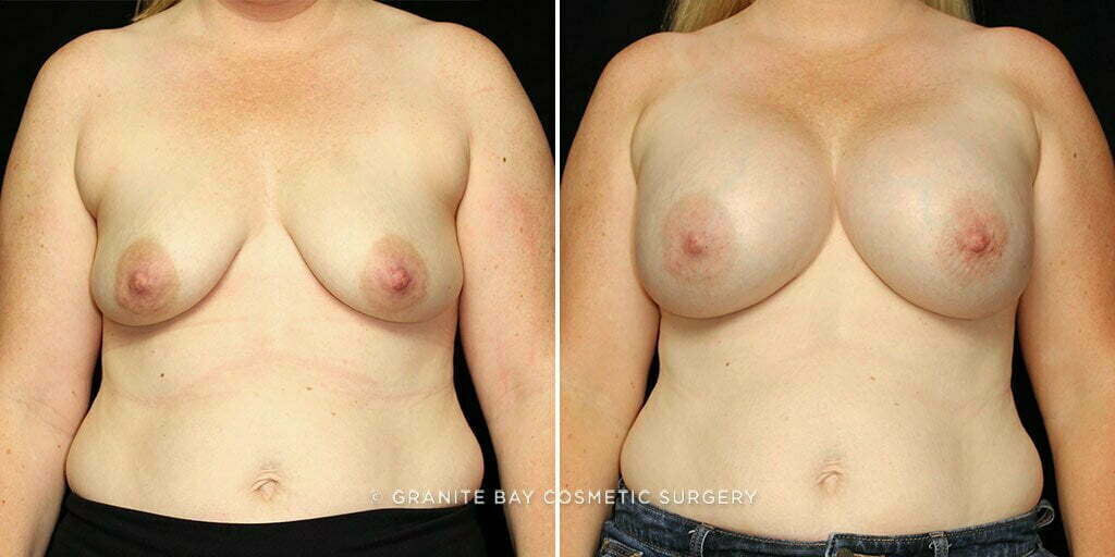 Case # 50 after photo