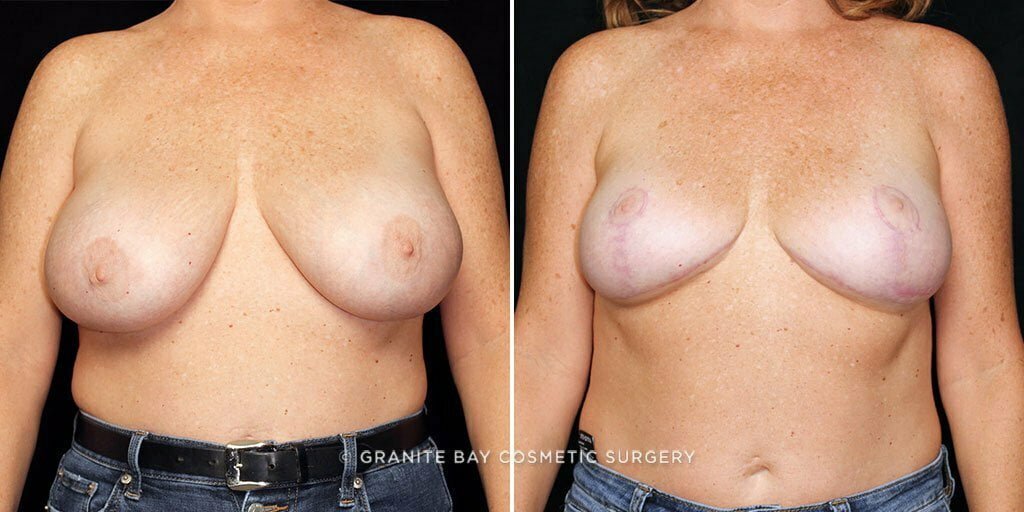 Case # 12 after photo