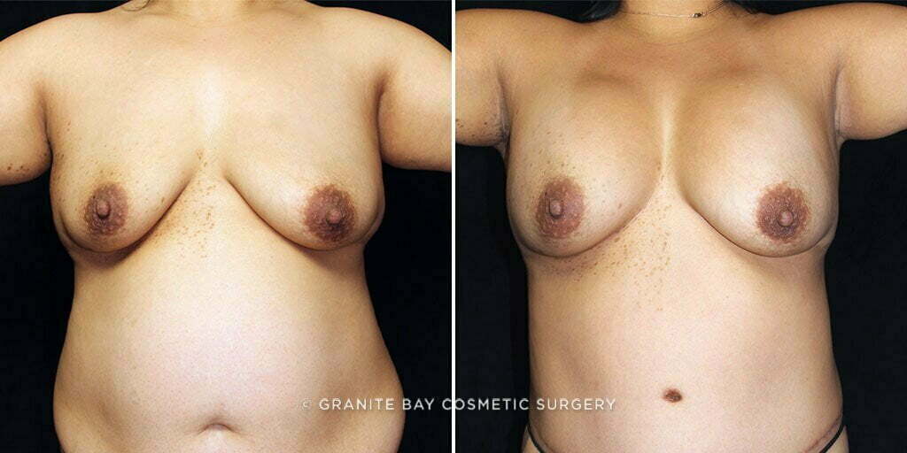 Case # 51 after photo