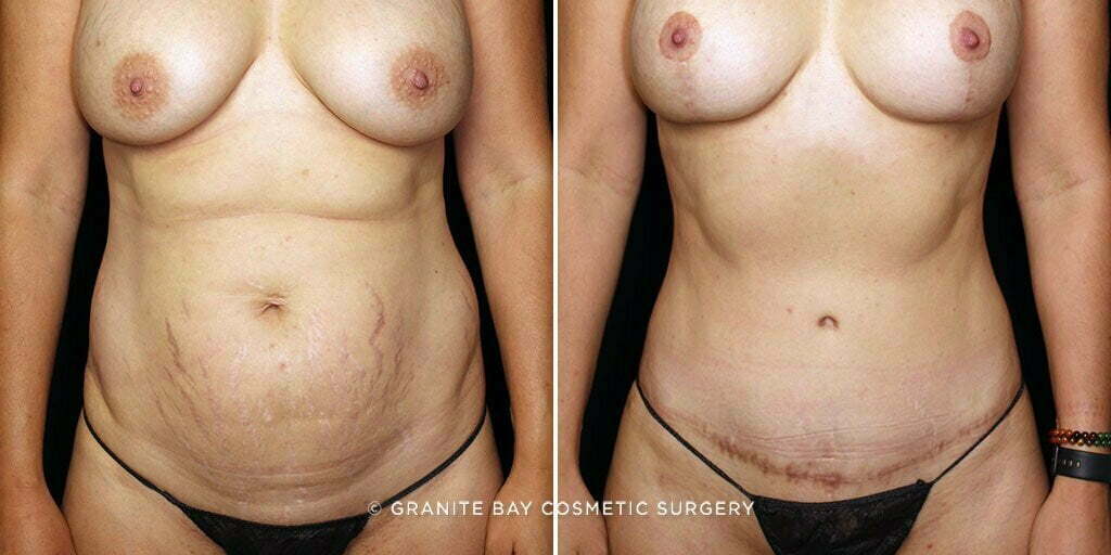 Case # 50 after photo