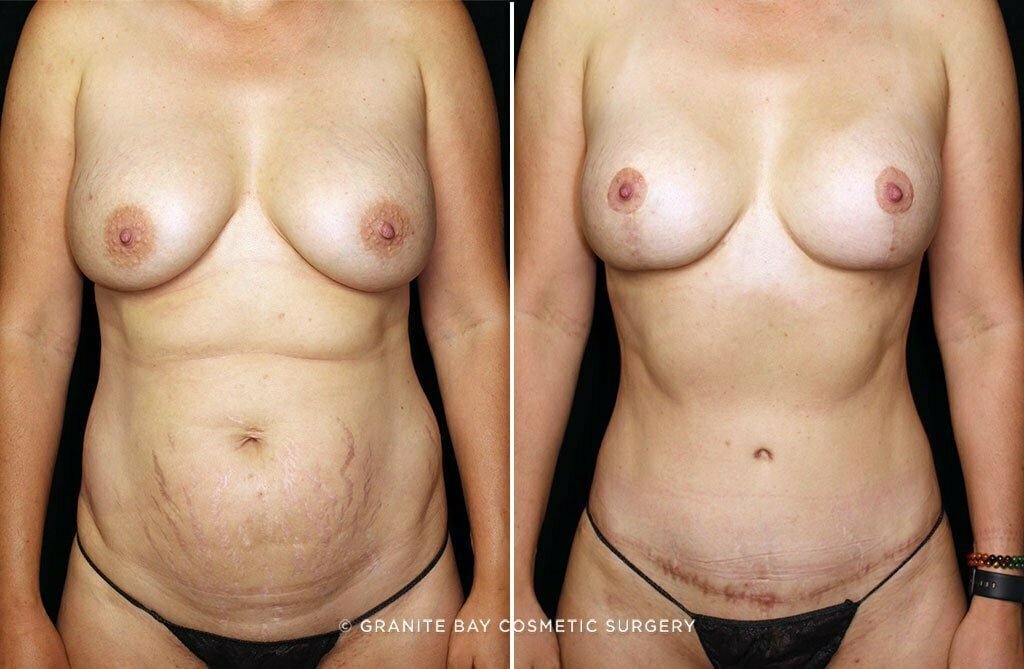 Case # 30 after photo