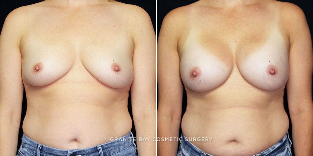 Case # 52 after photo