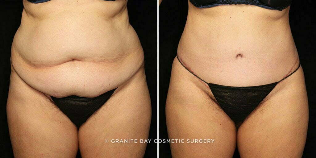 Case # 51 after photo