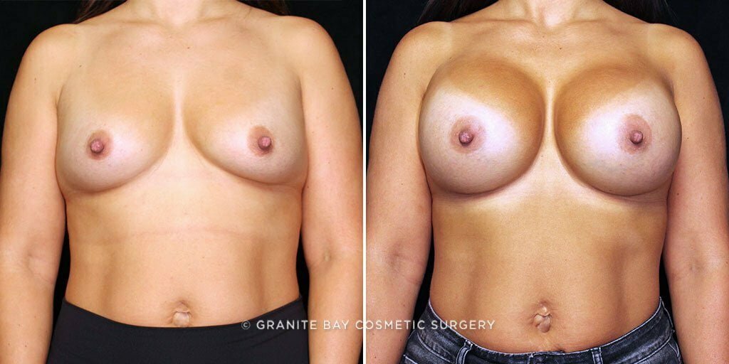 Case # 54 after photo