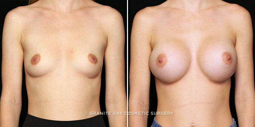 Case # 55 after photo