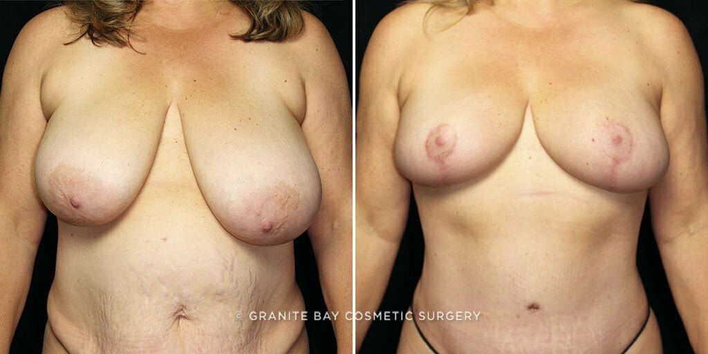 Case # 13 after photo