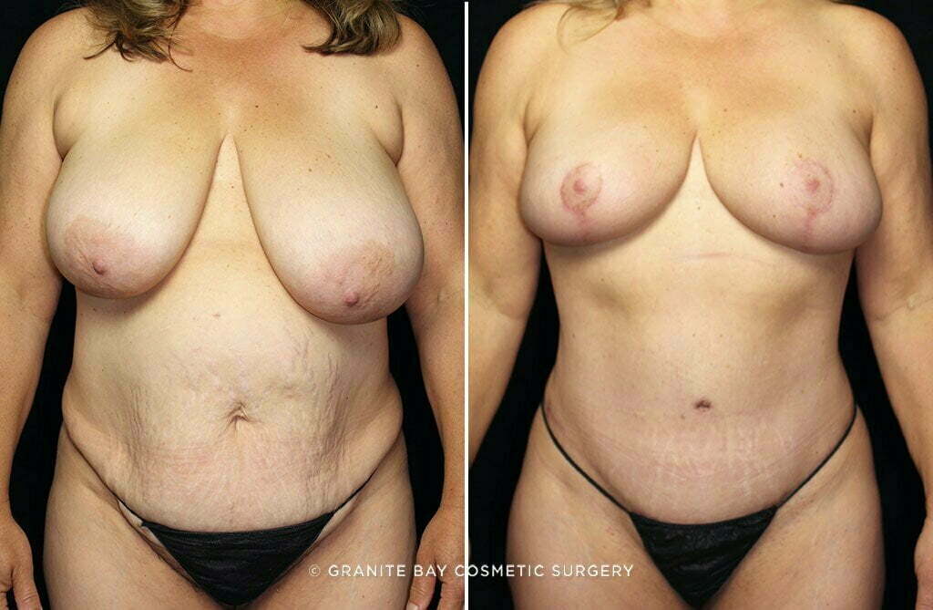 Case # 31 after photo