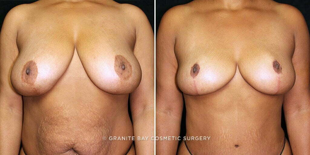 Case # 14 after photo