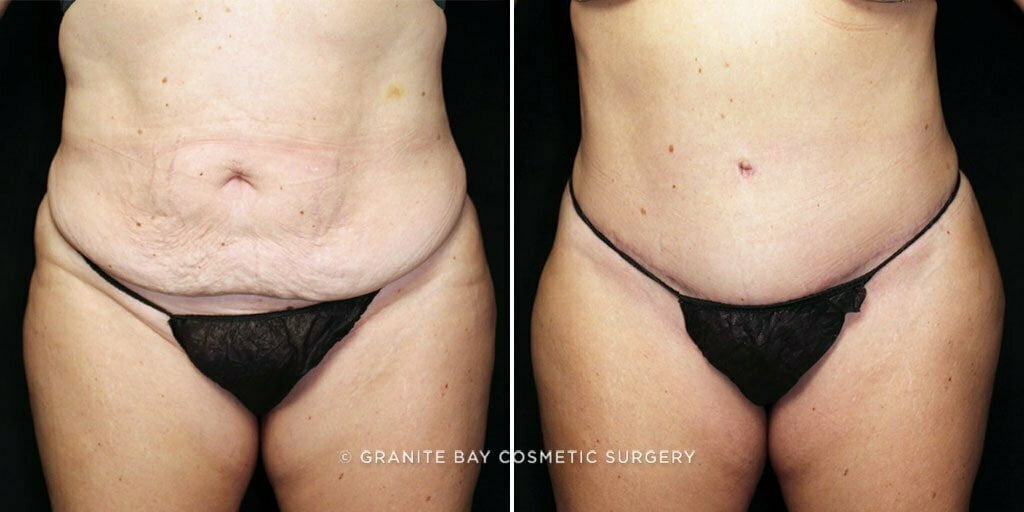 Case # 54 after photo