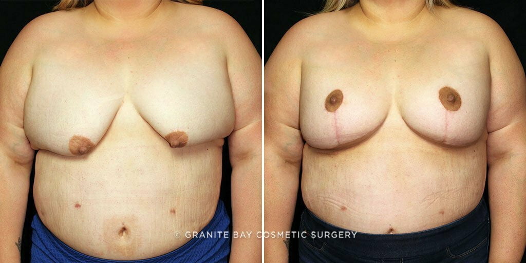 Case # 17 after photo