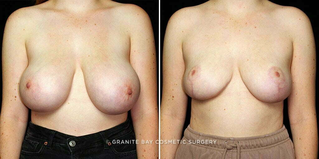 Case # 16 after photo