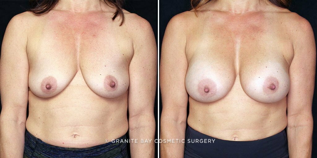 Case # 57 after photo