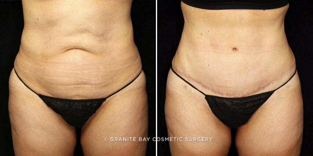 Case # 55 after photo