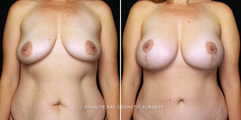 Case # 18 after photo