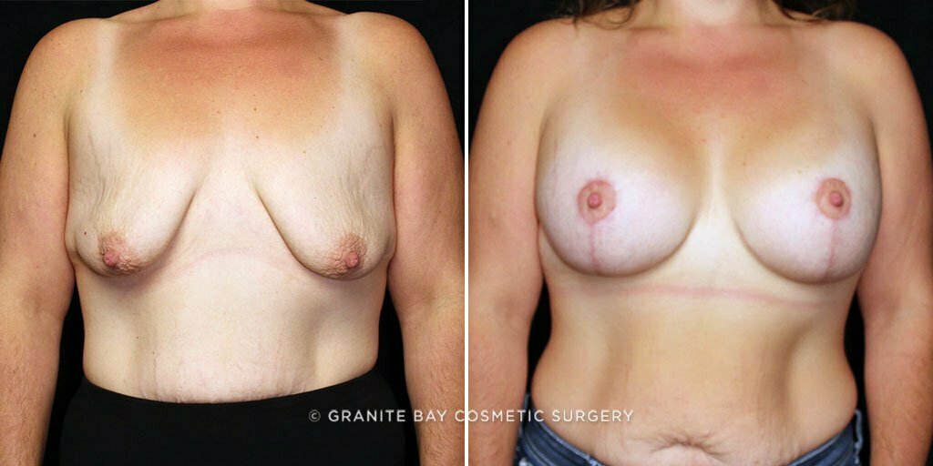 Case # 19 after photo