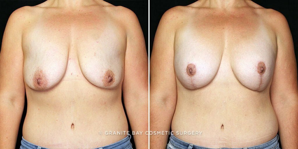 Case # 20 after photo