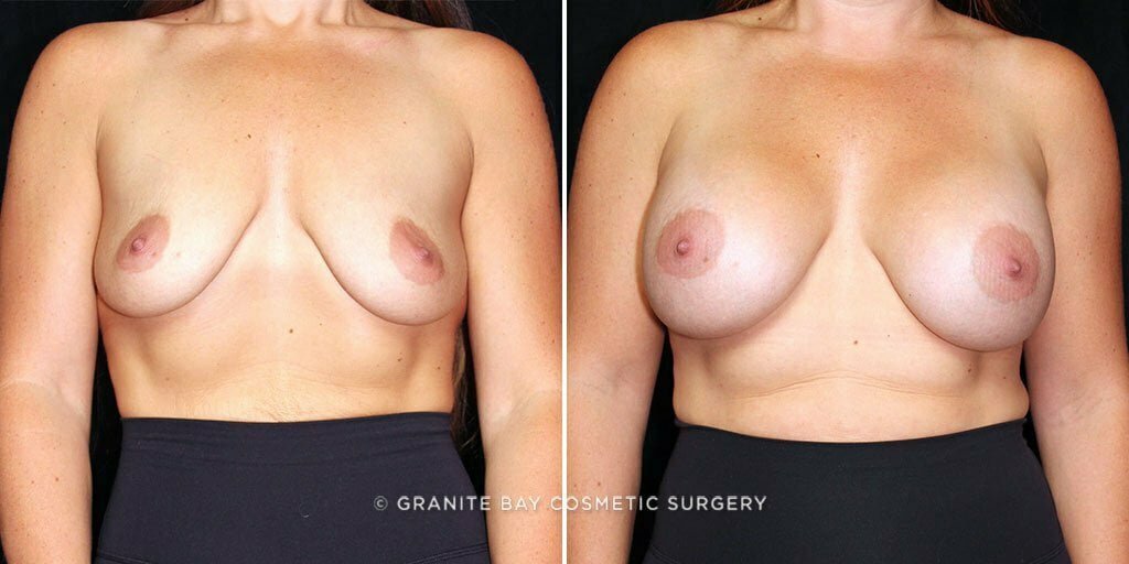 Case # 58 after photo