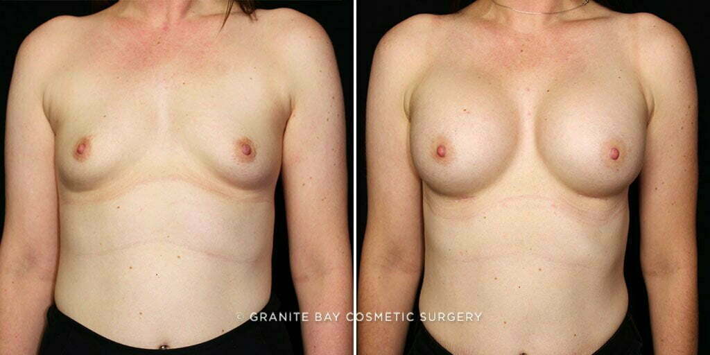 Case # 59 after photo