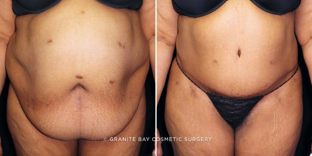 Case # 59 after photo