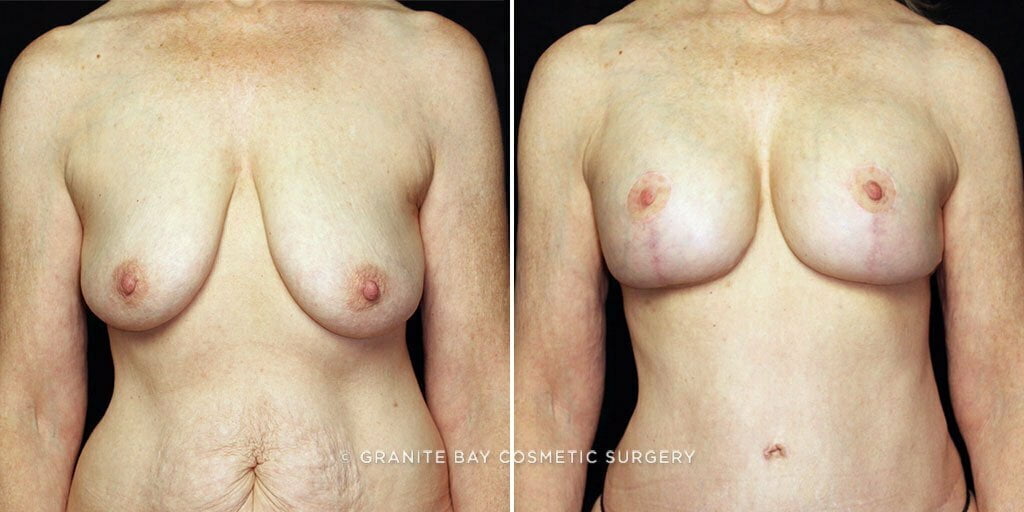 Case # 21 after photo