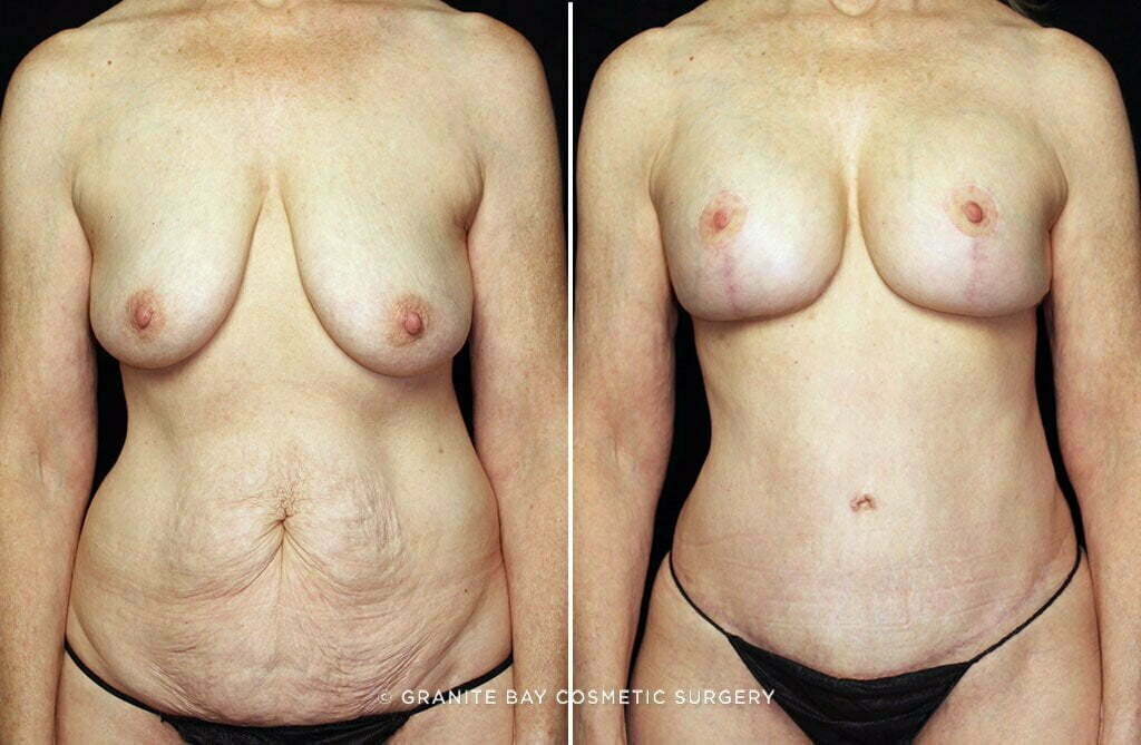 Case # 35 after photo