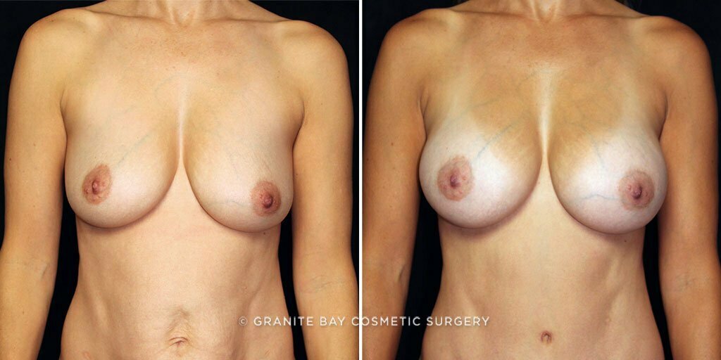 Case # 60 after photo