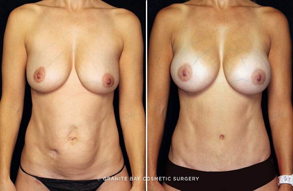 Case # 36 after photo