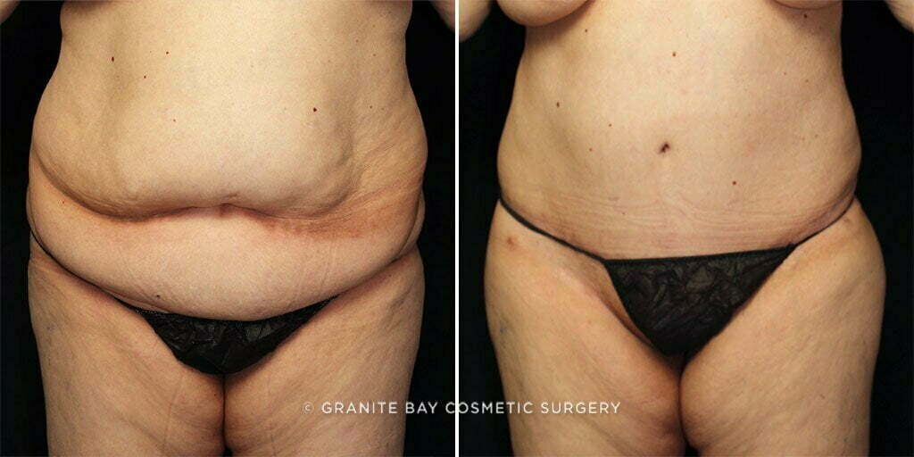 Case # 62 after photo