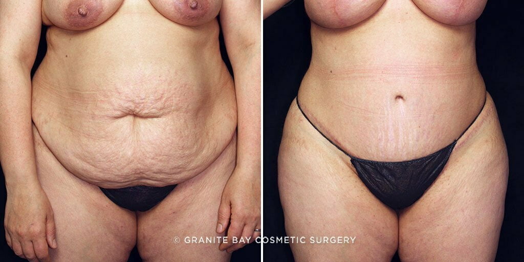 Case # 63 after photo