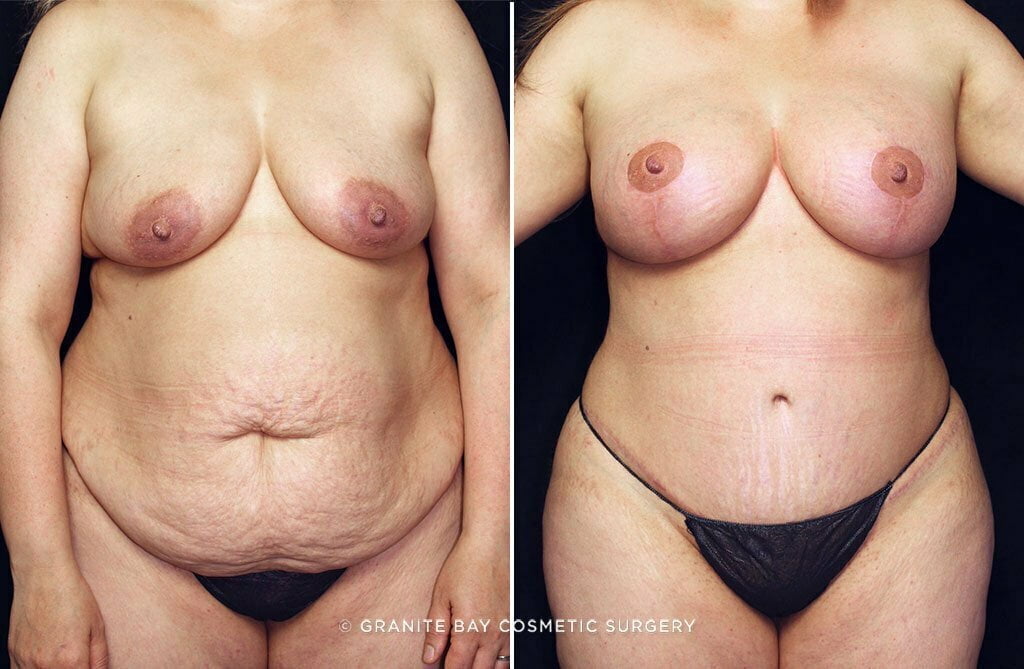 Case # 37 after photo