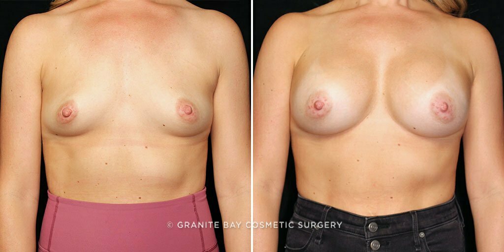 Case # 62 after photo