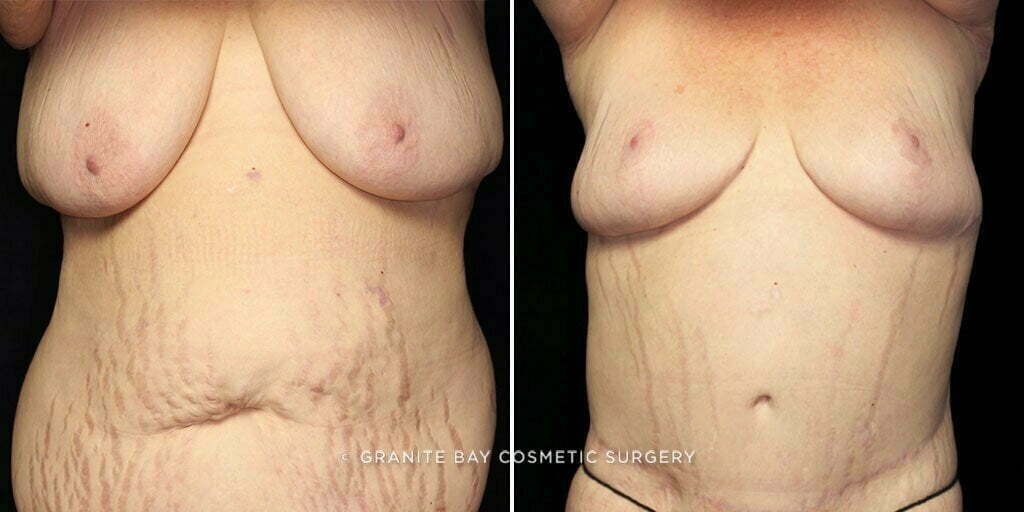 Case # 15 after photo