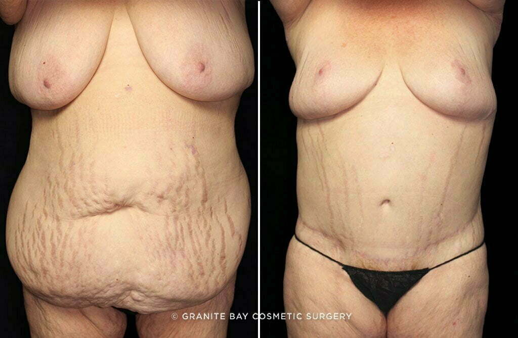 Case # 5 after photo