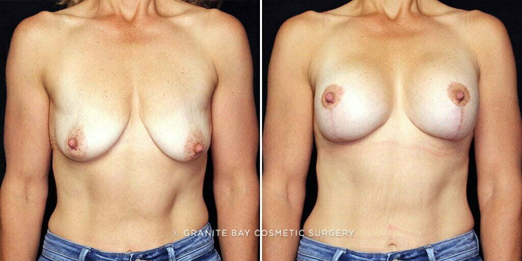 Case # 22 after photo