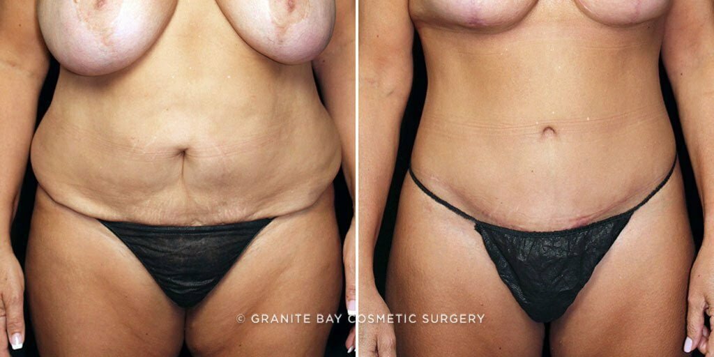 Case # 64 after photo