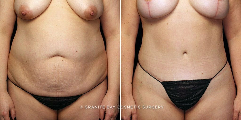 Case # 65 after photo