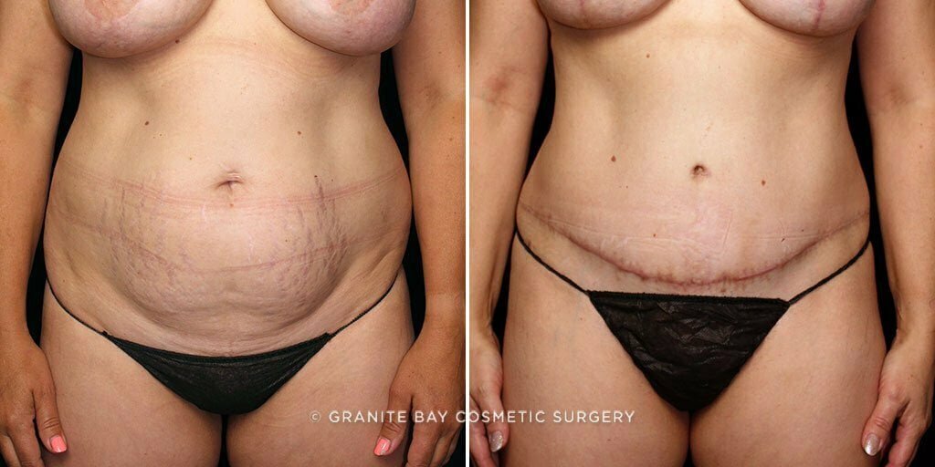 Case # 66 after photo