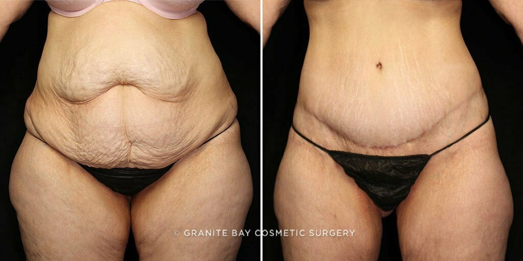 Case # 67 after photo