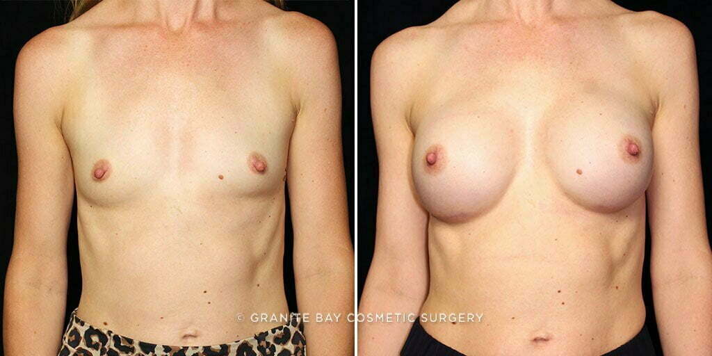 Case # 66 after photo