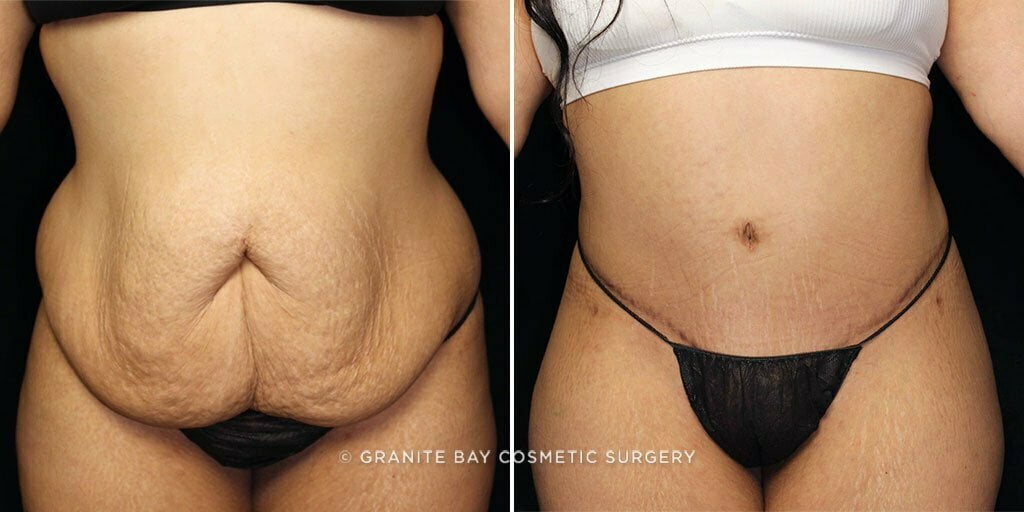 Case # 68 after photo