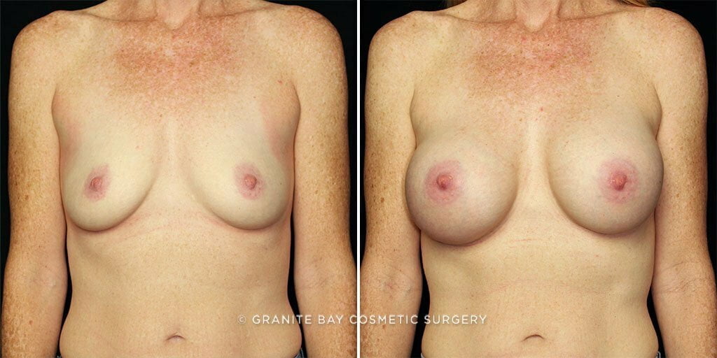 Case # 68 after photo