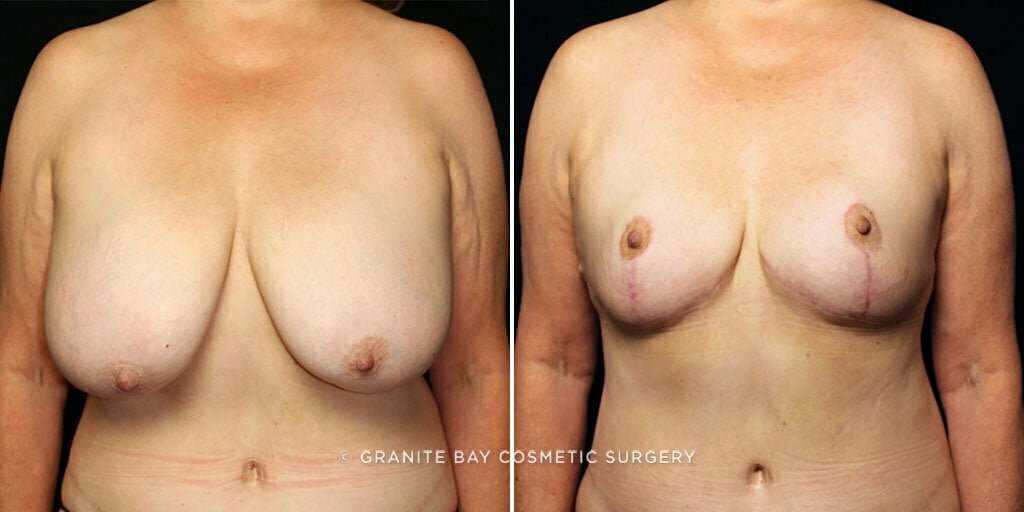 Case # 18 after photo